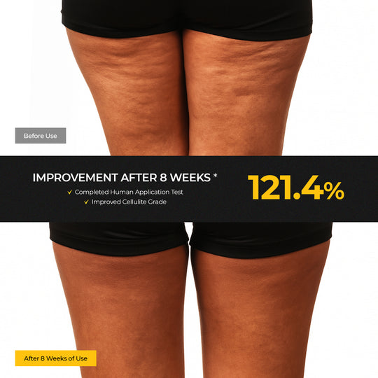 CALO EMS Slim Maker Pro Set